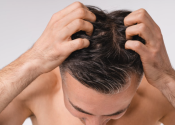 초기 탈모에 대한 핀페시아 의 이점 탐구